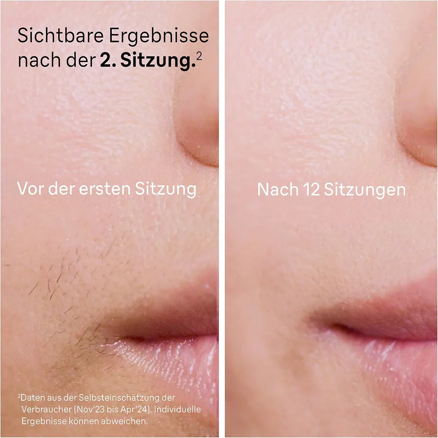 Braun IPL Geräte Haarentfernung Silk·expert Pro 5, PL5157, Weiß/Gold
